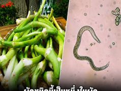ผักสดที่กินดิบอาจเสี่ยงพยาธิ! รู้วิธีล้างและเตรียมผักให้ปลอดภัยก่อนรับประทาน