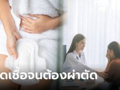 หญิงวัย 27 ปี ติดเชื้อรุนแรง เดินลำบาก แพทย์เตือนพฤติกรรมใช้ผ้าอนามัยที่ไม่ควรมองข้าม